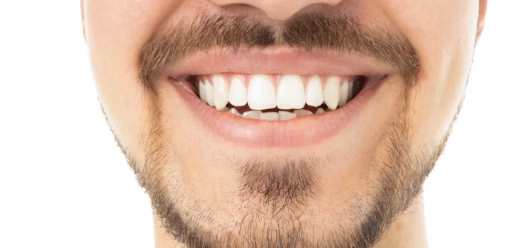 Gülüş Tasarımı Sonrası Bakım & Uzun Ömürlü Performans